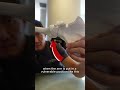 Latarjet Procedure Explained in Detail | 99% Success Rate for Shoulder Instability
