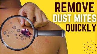 How To Get Rid Of Dust Mites Quickly? Amazing Proven Methods