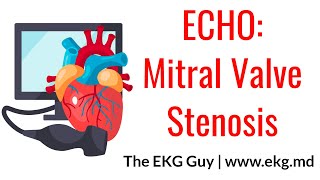 Mitral Valve Stenosis - ECHO Course l The EKG Guy - www.ekg.md