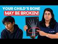 Bone Fracture in Children: Pediatrician Busts Myths on Surgery & Recovery