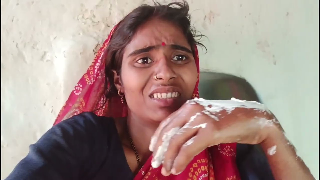 मैं और मेरा छोटा बेटा कृष्णा कैसे जल गए हम लोग