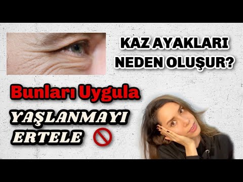 Video: Göz çevresindeki Kırışıklıkların Vaktinden önce Ortaya çıkmasına Neden Olan Hatalar