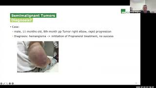 Road2IR: Vascular Malformations