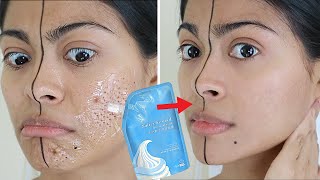 I tested VIRAL SALICYLIC ICE MASK & THIS HAPPENED! | Does the ice mask work instantly? 😳