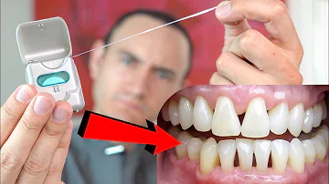 ¿No usar hilo dental amarillea los dientes?