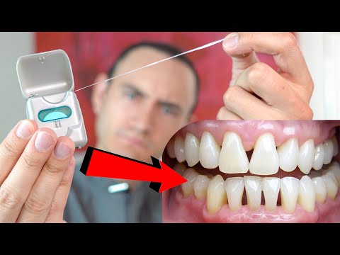 El Hilo Dental puede aflojar tus dientes. ¿Qué hacer para que eso no suceda?