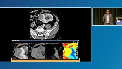 Benefits of Spectral CT in the Emergency Department