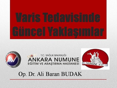 Varis Tedavisinde Güncel Yaklaşımlar