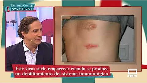 Come riconoscere un herpes sulla pelle?
