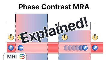 What is Phase-Contrast Magnetic Resonance Angiography (MRA)? - MRI explained