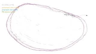 Dm-DRA2, a Drosophila Optic Lobe Intrinsic Neuron from optic-lobe:v1.0