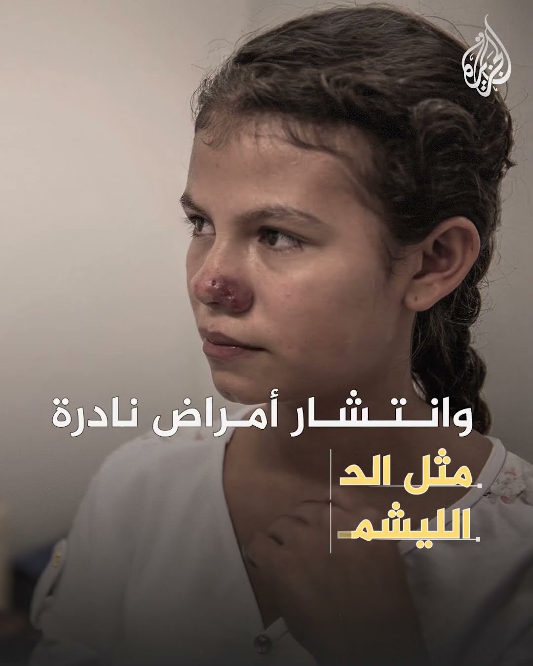 كيف أدت الحروب الحديثة إلى إنتاج جراثيم قاتلة؟