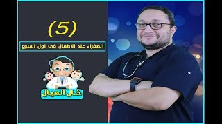 برنامج خال العيال - الحلقة الخامسة الصفراء عند الاطفال فى اول اسبوع