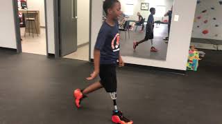 AK Knee Disarticulate Amputee Walking on Patterson Propulsion Socket PPS Prosthetic Leg
