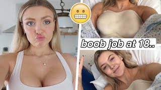 WHY I REGRET MY BOOB JOB @ 18 YEARS OLD... my experience, pain + scars (before vs after)