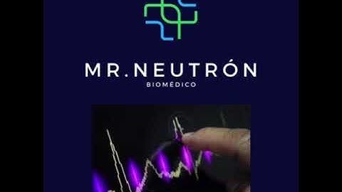 ECG CON ARDUINO BPM EN TIEMPO REAL
