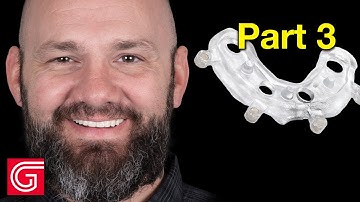 HOW TO Place an Implant Prosthesis Using a Surgical Guide