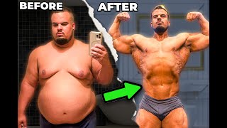 I Got Loose Skin Removal Surgery (Tummy Tuck)