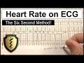 Ecg heart rate calculation  the six second method