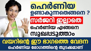 ഹെർണിയ രോഗം ഉണ്ടാകുന്നതെങ്ങനെ ? സർജറി ഇല്ലാതെ Hernia എങ്ങനെ സുഖപ്പടുത്താം | Hernia Malayalam