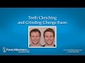 Teeth Clenching and Grinding Change Faces Teeth Clenching and Grinding Change Faces