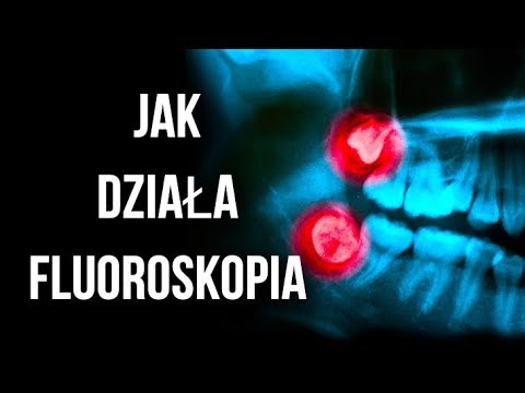 Jak działa fluoroskopia (RTG)