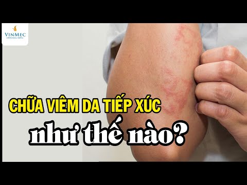 viêm da tiếp xúc - Chữa viêm da tiếp xúc như thế nào? BS Nguyễn Thị Thu Trang, BV  Vinmec Central Park