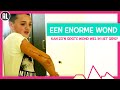 WAT ALS JE HELE ARM EEN WOND IS? - TOPDOKS EXTRA - TOPDOKS