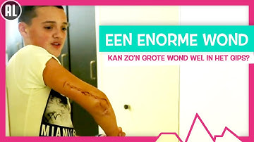 WAT ALS JE HELE ARM EEN WOND IS? - TOPDOKS SEH