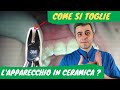 Come si toglie l&#39;apparecchio in ceramica?