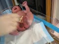 Baby's First Breath- VERY Rough Nurse