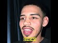 Benavidez beats usyk he’s best fighter in the world says Diego Pacheco