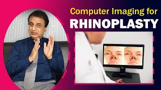 Computer Imaging in Rhinoplasty, Nose Job कंप्यूटर इमेजिंग और वास्तविक रिजल्ट |  Dr. PK Talwar Net Worth