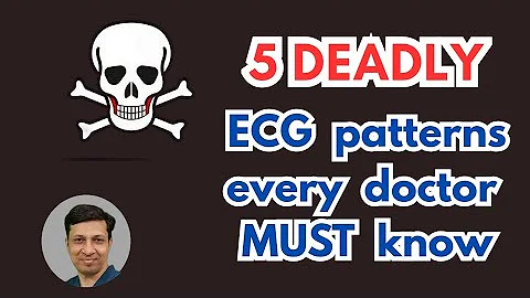 5 Deadly ECG Patterns Every Doctor Must Know | Life-Saving ECG Interpretation Guide