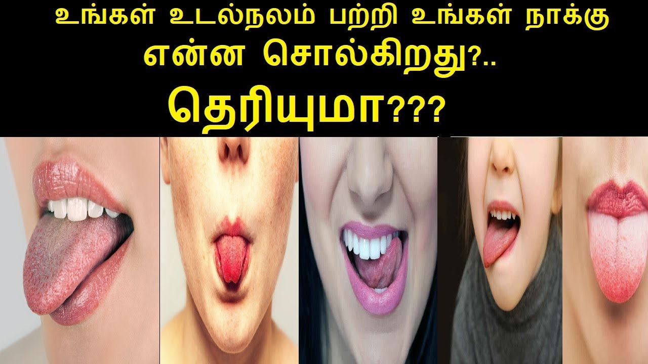 What Your Tongue Can Tell You About Your Health in Tamil Rahul Health