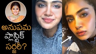 Actress Anupama Parameswaran Plastic Surgery Gone Wrong | News Buzz