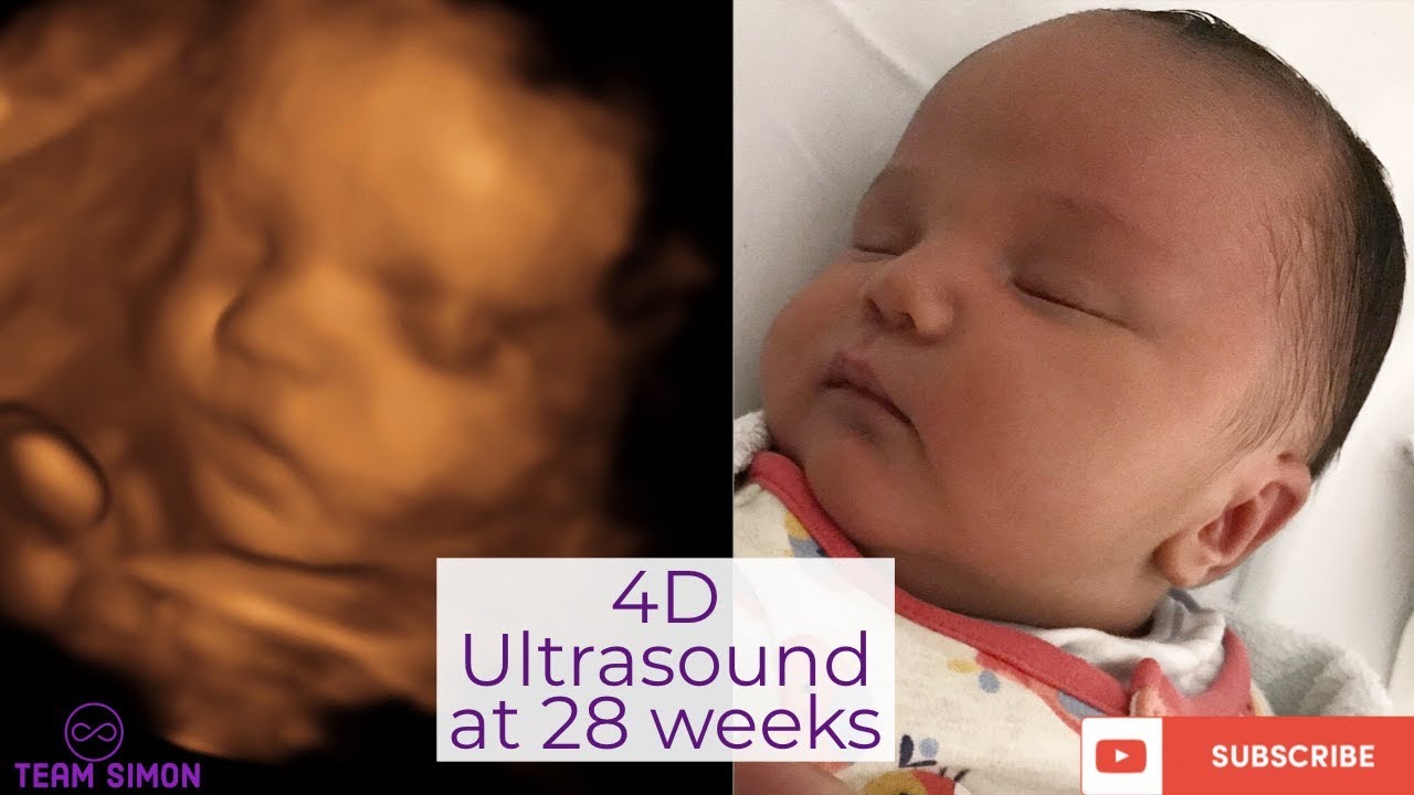 4d Ultrasound at 28 weeks Baby Journey THE SIMON FAMILY YouTube