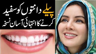 My Secret to go from Yellow to White Teeth | Rabi Pirzada