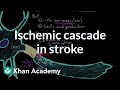 Understanding Stroke and Neuron Damage