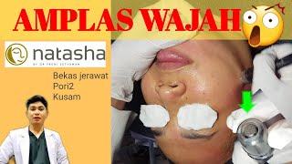 BAHAS TUNTAS HARGA LASER CO2 NATASHA SKIN CARE | MENGHILANGKAN TAHI LALAT