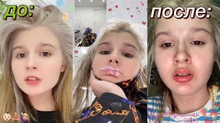 картинка: зачем я снова УВЕЛИЧИЛА ГУБЫ?