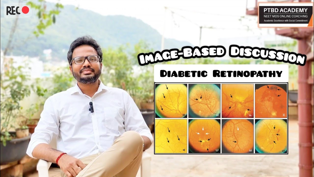 LIVE 🔴 | Diabetic Retinopathy – Overview