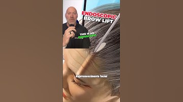 Forehead Brow Lift Breakdown 🧐 #shorts