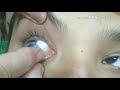 How To Apply Contact Lenses ( HINDI)Easy and Simple