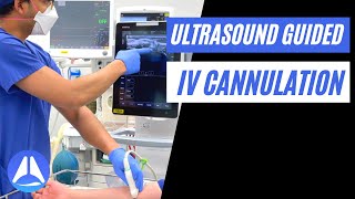 Intravenous (IV) Cannulation under Ultrasound (US) guidance - 5 steps to optimise your view!