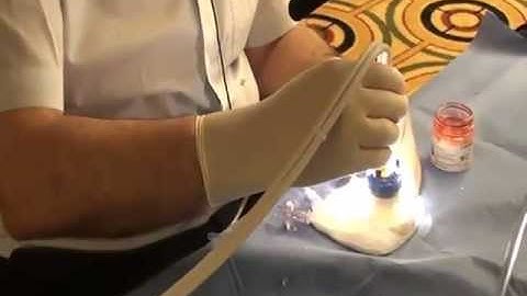Pachymetry during DSAEK tissue prepration