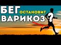 Пробежки и варикоз? Как остановить варикоз?