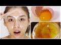 វិធីធ្វើម៉ាសពងមាន់បកមុនខ្សាច់ បន្តឹងស្បែកមុខនិងបំបាត់មុខមុន - Egg mask for acne face
