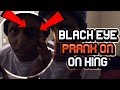 Black eye PRANK w/Funnymike on King FROM NIQUE AND KING