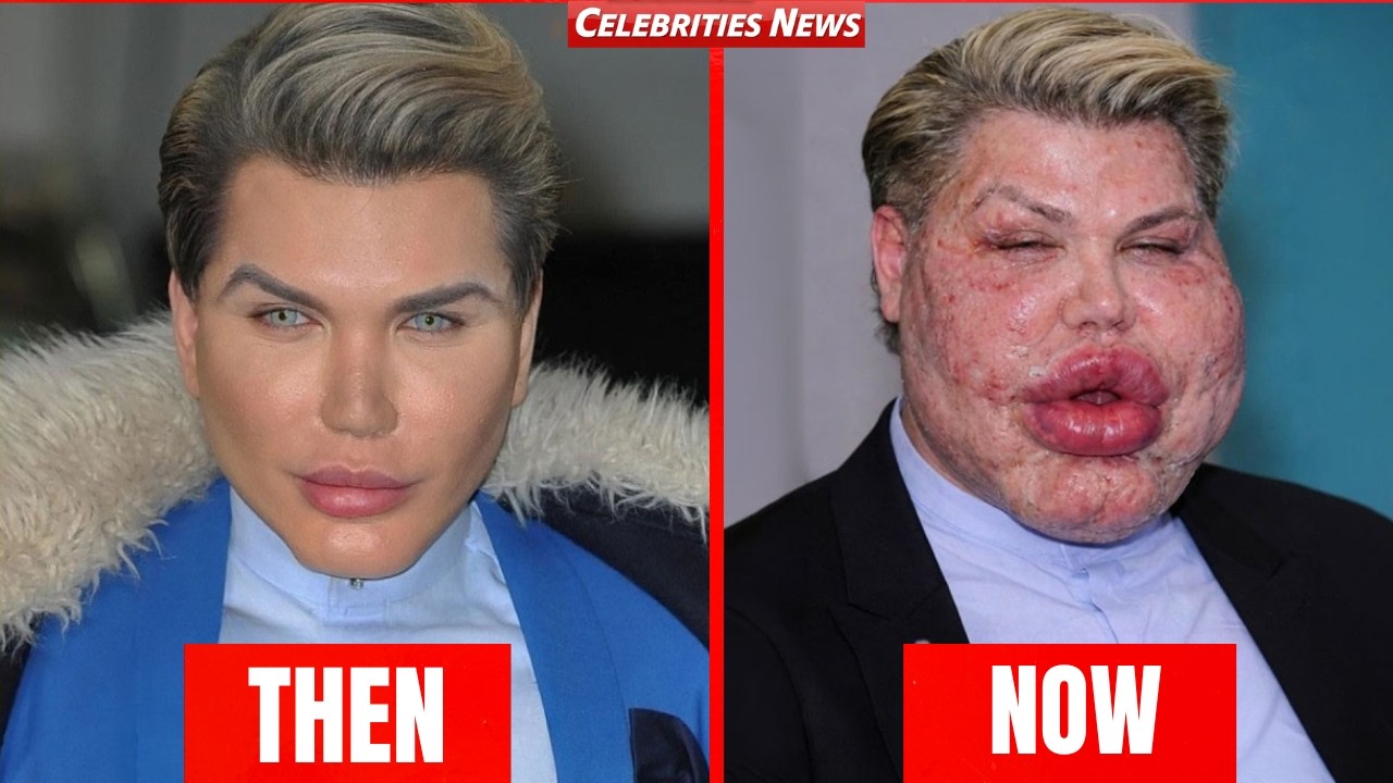 10 Celebrities Before and After Plastic Surgery | Then and Now 2026 ...